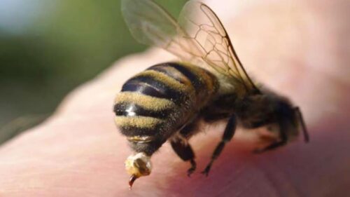 Укус пчелы - симптомы и первая помощь при укусах